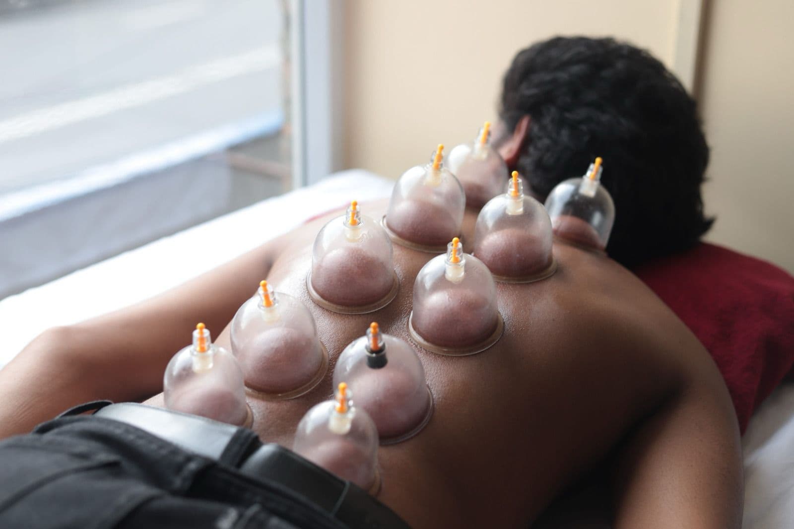 Best cupping therapy in nepal