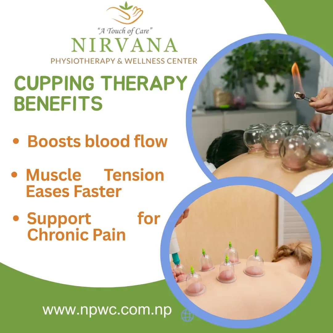 Cupping therapy session at Nirvana Physiotherapy & Wellness Center showing glass cups applied to a patient’s back, promoting benefits such as improved blood flow, reduced muscle tension, and chronic pain support.
