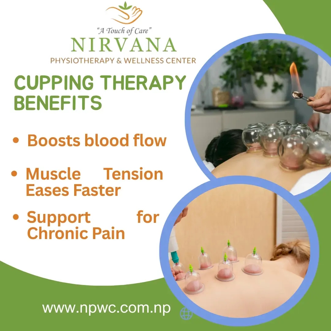 Cupping therapy session at Nirvana Physiotherapy & Wellness Center showing glass cups applied to a patient’s back, promoting benefits such as improved blood flow, reduced muscle tension, and chronic pain support.